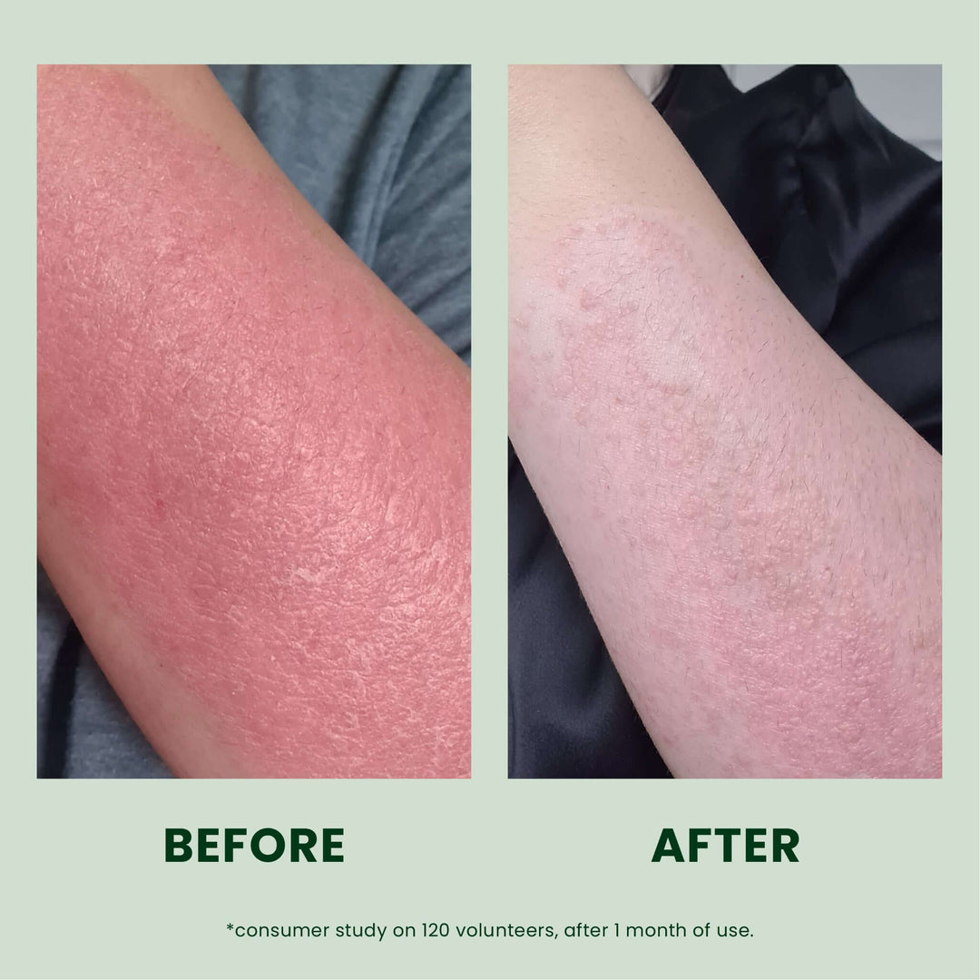 Nurture Lotion 50 ML | Vulnerable, Dry Skin Lotion